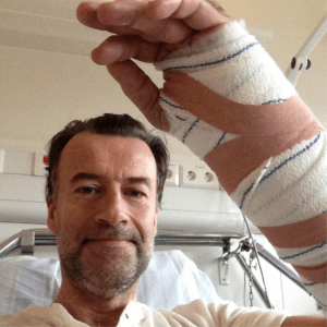 I dag fick jag skruvar och metallskena inopererad i vänster underarm. 